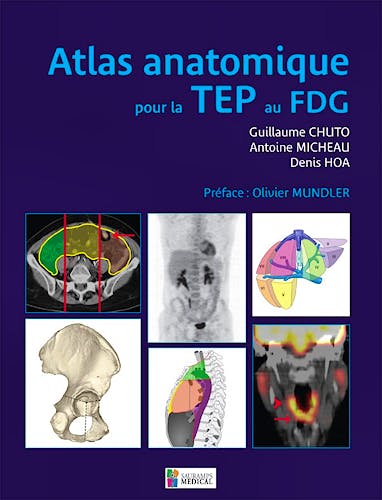 Portada del libro 9782840238089 Atlas Anatomique Pour la Tep Au Fdg