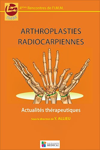 Portada del libro 9782840238287 Arthroplasties Radiocarpiennes. Actualités Thérapeutiques - 4èmes Rencontres de L'imm