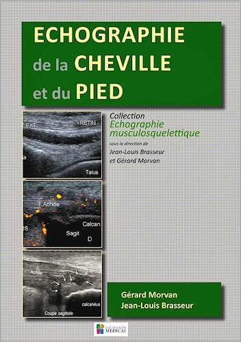 Portada del libro 9782840238584 Echographie de la Cheville et du Pied