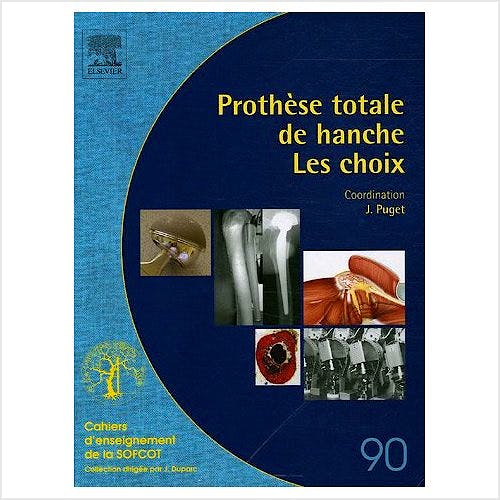 Portada del libro 9782842997069 Prothèse Totale de Hanche : Les Choix