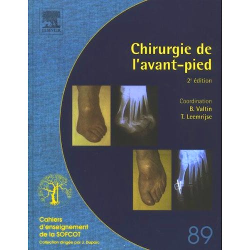 Portada del libro 9782842997175 Chirurgie de l´Avant-Pied (Cahiers d´Enseignement de la SOFCOT)