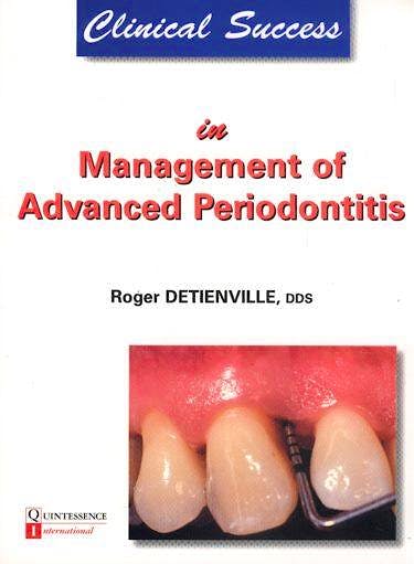 Portada del libro 9782912550415 Clinical Success in Management of Advanced Periodontitis