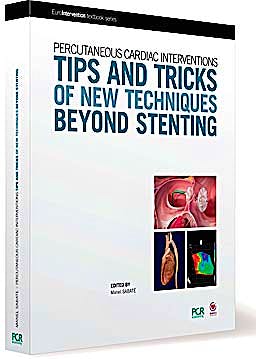 Portada del libro 9782913628557 Tips and Tricks of New Techniques beyond Stenting. Percutaneous Cardiac Interventions