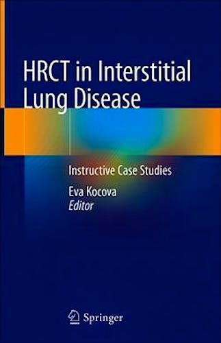 Portada del libro 9783030163143 HRCT in Interstitial Lung Disease. Instructive Case Studies