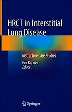 HRCT in Interstitial Lung Disease. Instructive Case Studies
