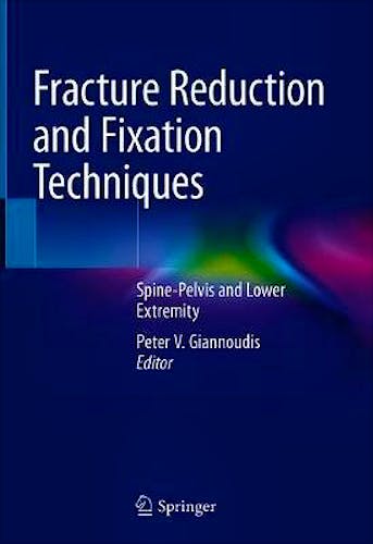 Portada del libro 9783030246075 Fracture Reduction and Fixation Techniques. Spine-Pelvis and Lower Extremity
