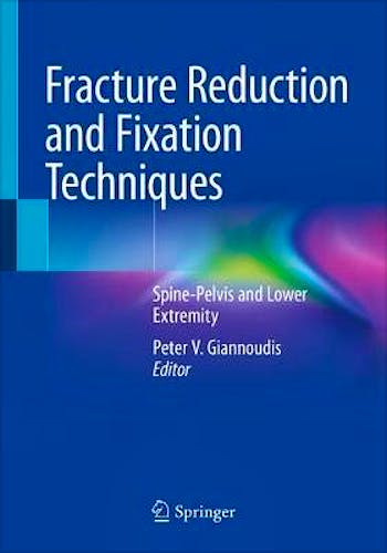 Portada del libro 9783030246105 Fracture Reduction and Fixation Techniques. Spine-Pelvis and Lower Extremity