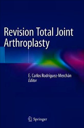 Portada del libro 9783030247720 Revision Total Joint Arthroplasty
