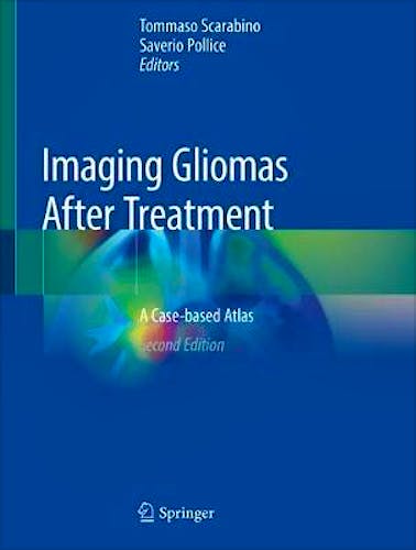 Portada del libro 9783030312121 Imaging Gliomas After Treatment. A Case-based Atlas
