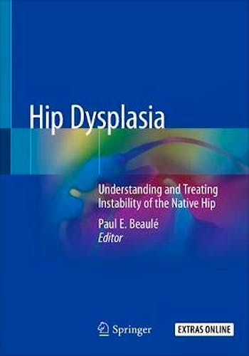 Portada del libro 9783030333607 Hip Dysplasia. Understanding and Treating Instability of the Native Hip