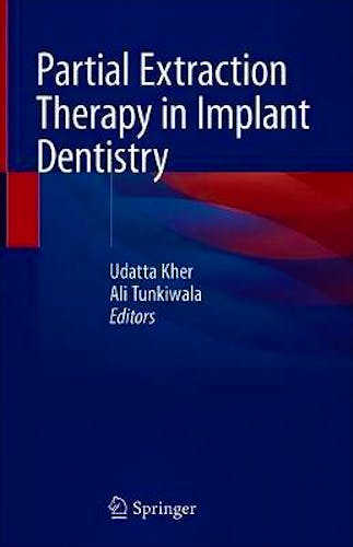 Portada del libro 9783030336097 Partial Extraction Therapy in Implant Dentistry