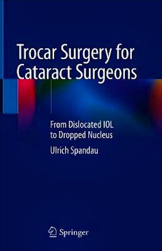 Portada del libro 9783030360924 Trocar Surgery for Cataract Surgeons. From Dislocated IOL to Dropped Nucleus