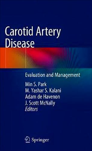Portada del libro 9783030411374 Carotid Artery Disease. Evaluation and Management