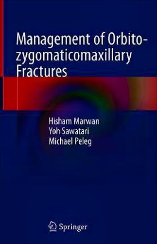 Management of Orbito-Zygomaticomaxillary Fractures