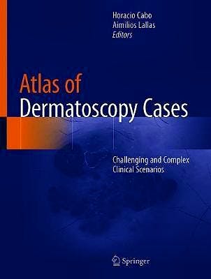 Portada del libro 9783030436711 Atlas of Dermatoscopy Cases. Challenging and Complex Clinical Scenarios