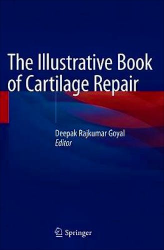 Portada del libro 9783030471538 The Illustrative Book of Cartilage Repair
