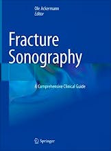 Fracture Sonography. A Comprehensive Clinical Guide