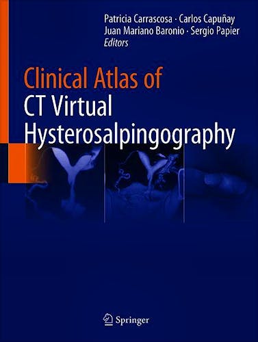 Clinical Atlas of CT Virtual Hysterosalpingography