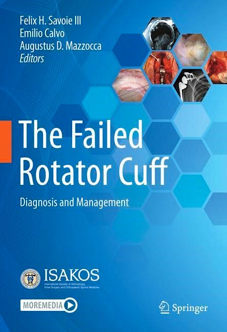 Portada del libro 9783030794804 The Failed Rotator Cuff. Diagnosis and Management