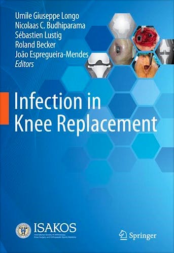 Portada del libro 9783030815523 Infection in Knee Replacement