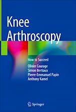 Portada del libro 9783030828295 Knee Arthroscopy. How to Succeed