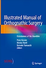 Portada del libro 9783031069772 Illustrated Manual Of Orthognathic Surgery: Osteotomies Of The Mandible