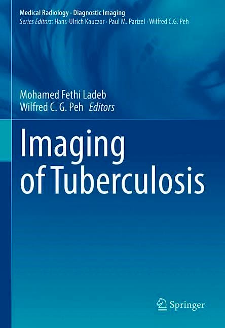 Portada del libro 9783031070396 Imaging of Tuberculosis