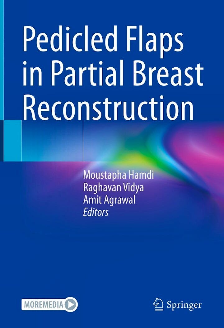 Portada del libro 9783031084829 Pedicled Flaps in Partial Breast Reconstruction