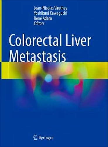 Portada del libro 9783031093227 Colorectal Liver Metastasis