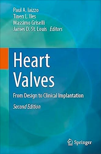 Heart Valves. From Design to Clinical Implantation