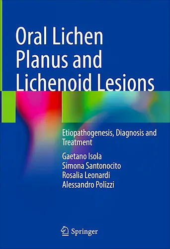 Portada del libro 9783031297649 Oral Lichen Planus and Lichenoid Lesions. Etiopathogenesis, Diagnosis and Treatment