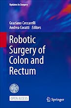 Portada del libro 9783031330193 Robotic Surgery of Colon and Rectum