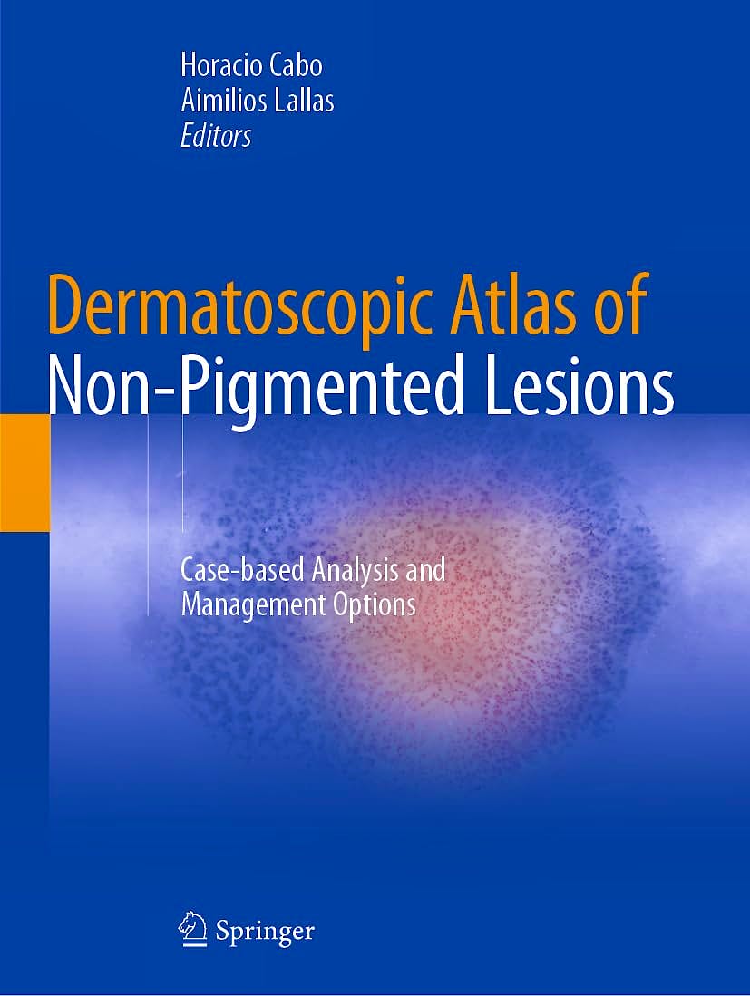 Portada del libro 9783031343124 Dermatoscopic Atlas of Non-Pigmented Lesions. Case-Based Analysis and Management Options