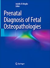 Prenatal Diagnosis Of Fetal Osteopathologies