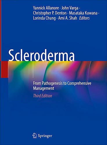 Portada del libro 9783031406577 Scleroderma. From Pathogenesis to Comprehensive Management