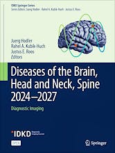Portada del libro 9783031506741 Diseases Of The Brain, Head And Neck, Spine 2024-2027: Diagnostic Imaging