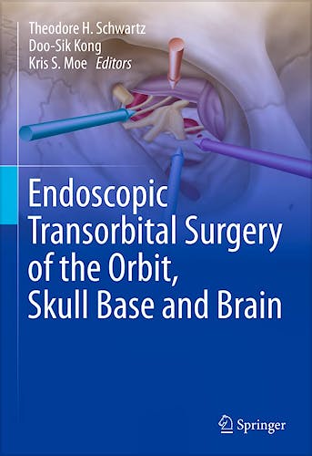 Portada del libro 9783031595035 Endoscopic Transorbital Surgery of the Orbit, Skull Base and Brain