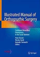Portada del libro 9783031735912 Illustrated Manual of Orthognathic Surgery. Combined Bimaxillary Osteotomies in the Facial Skeleton