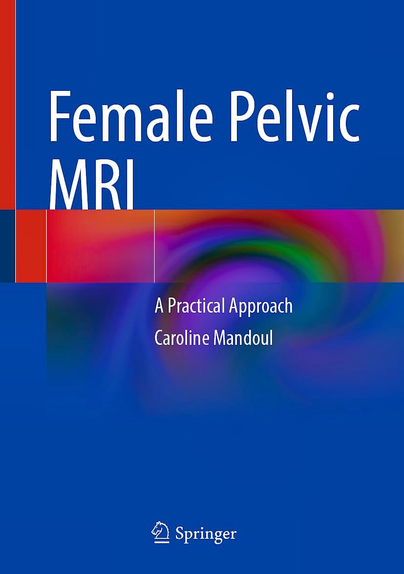 Portada del libro 9783031766831 Female Pelvic MRI. A Practical Approach
