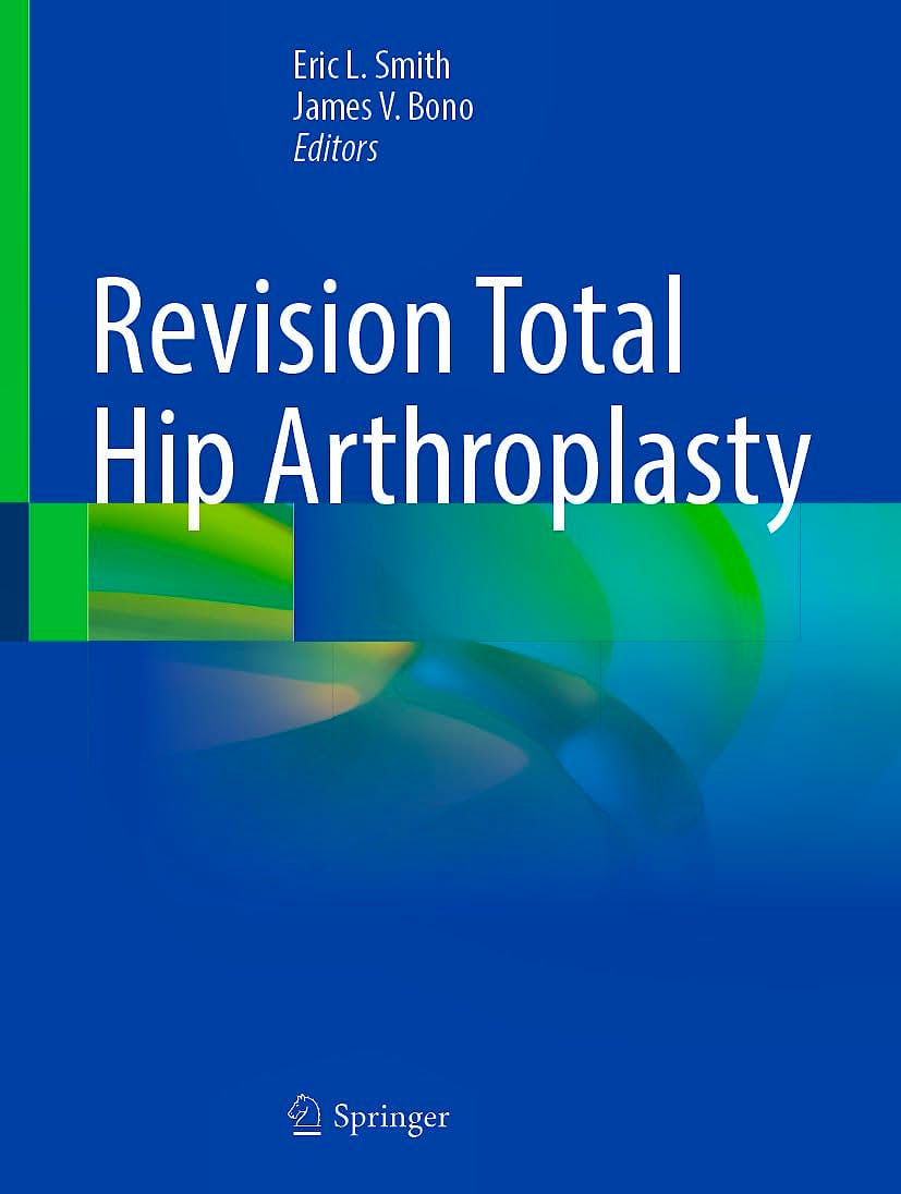 Portada del libro 9783031839580 Revision Total Hip Arthroplasty