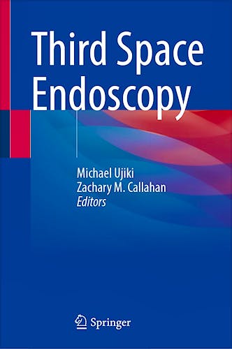 Portada del libro 9783031845086 Third Space Endoscopy