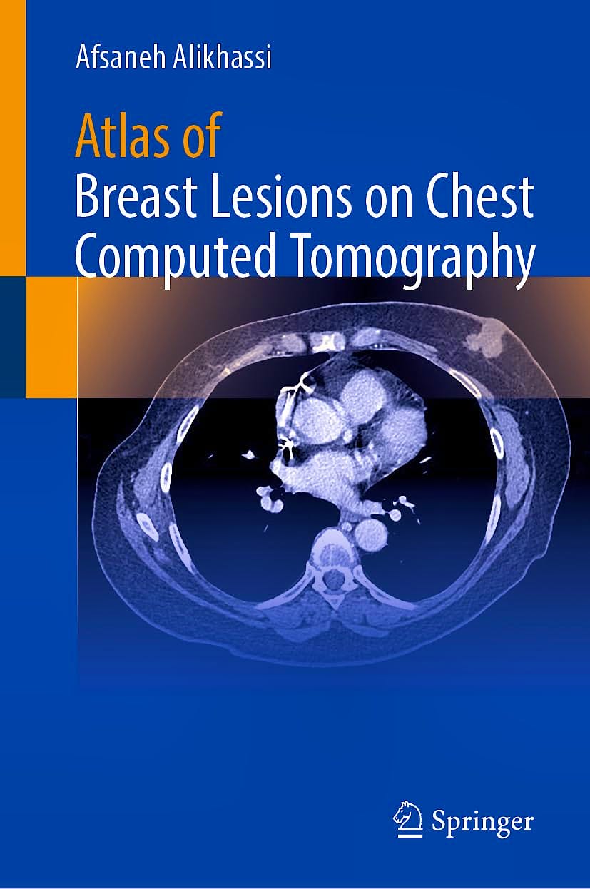 Portada del libro 9783032227904 Atlas Of Breast Lesions on Chest Computed Tomography