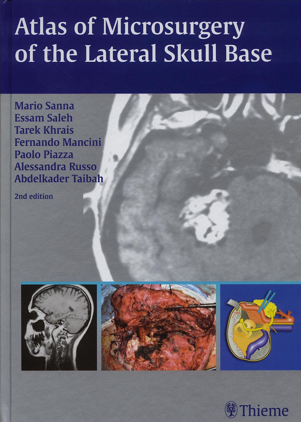 Portada del libro 9783131010926 Atlas of Microsurgery of the Lateral Skull Base