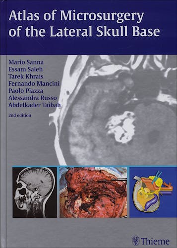 Portada del libro 9783131010926 Atlas of Microsurgery of the Lateral Skull Base