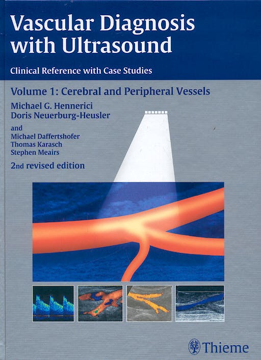 Portada del libro 9783131038326 Vascular Diagnosis with Ultrasound. Clinical Reference with Case Studies, Vol. 1: Cerebral and Peripheral Vessels