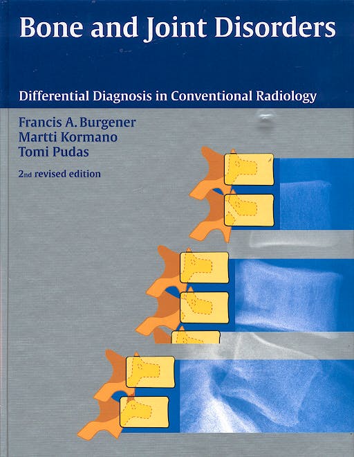 Portada del libro 9783131073921 Bone and Joint Disorders