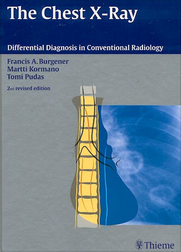 Portada del libro 9783131076120 The Chest X-Ray. Differential Diagnosis in Conventional Radiology