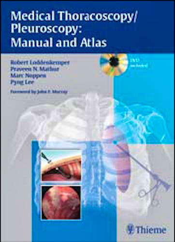 Portada del libro 9783131082213 Medical Thoracoscopy/pleuroscopy: Manual and Atlas