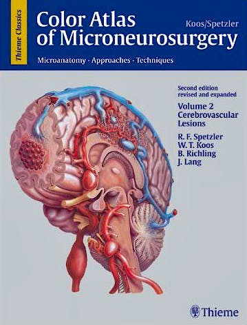 Portada del libro 9783131111029 Color Atlas of Microneurosurgery, Vol. 2: Cerebrovascular Lesions