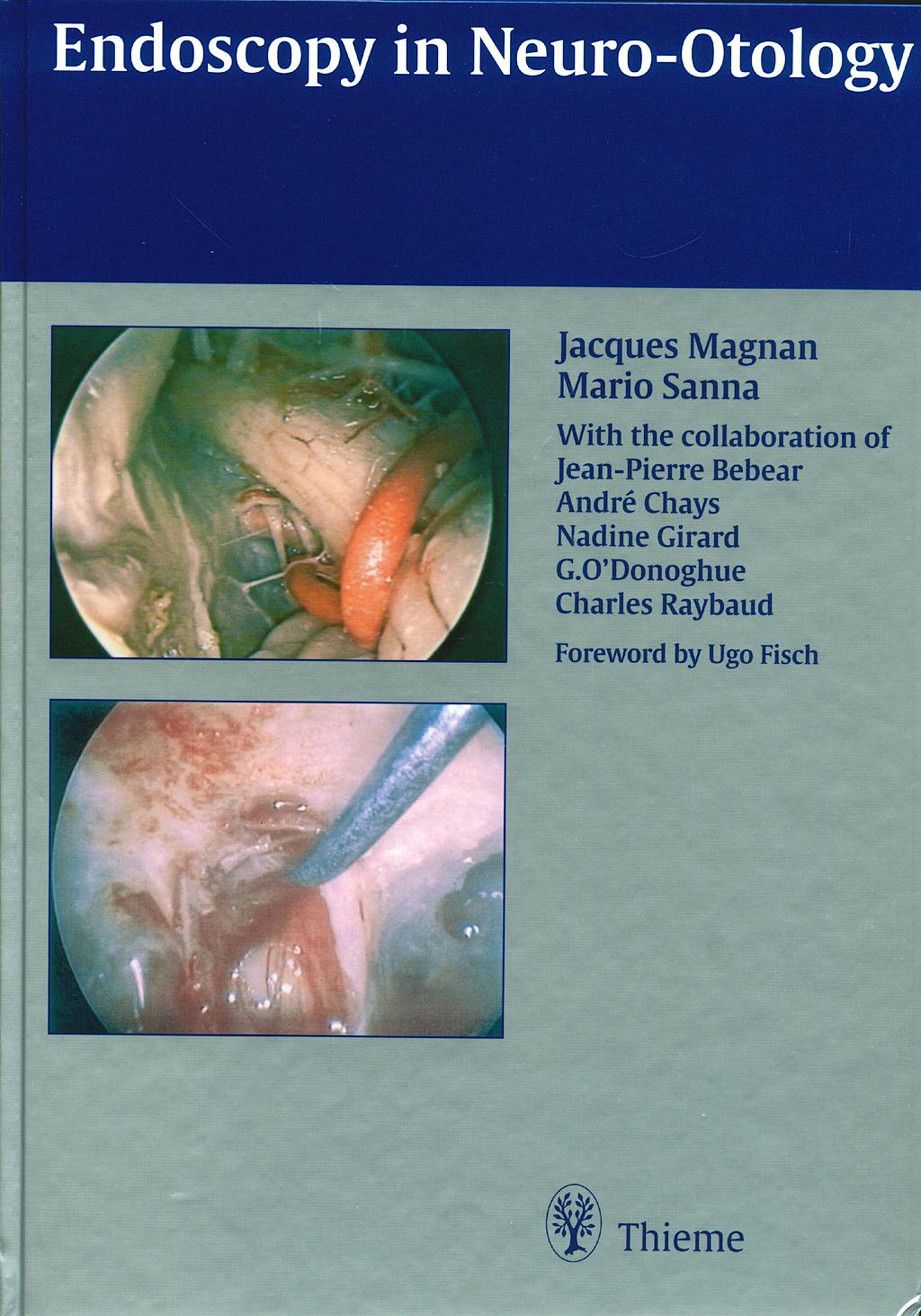 Portada del libro 9783131130617 Endoscopy in Neurootology